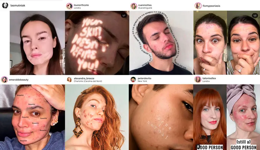 skin positivity