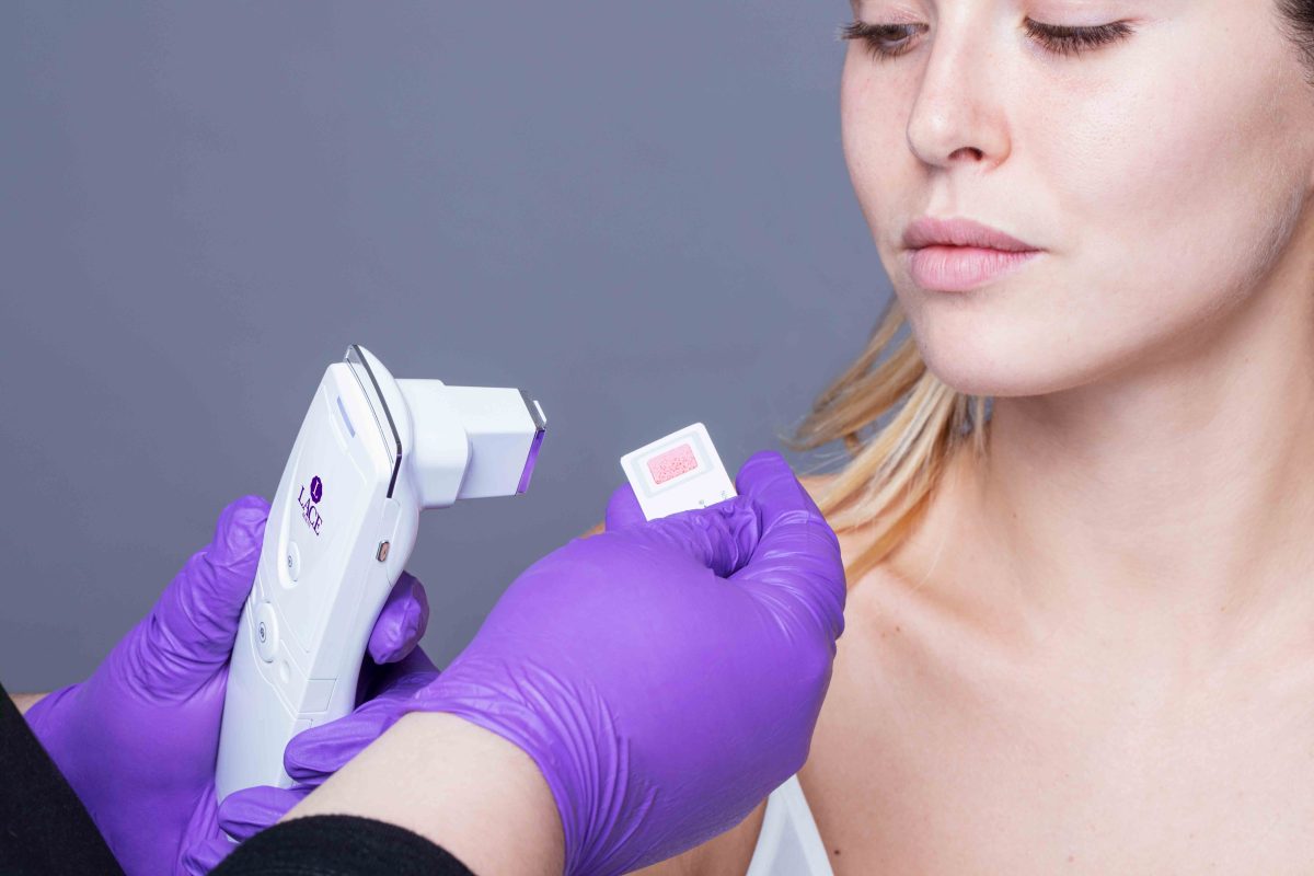 consulenza e analisi della pelle